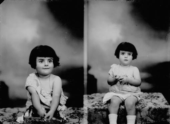 Enfant curiste. Paris. Mignovillard